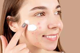 Salicylic Acid Benefits: What Does Salicylic Acid Do For Your Skin?