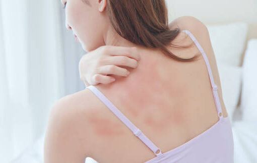 Understanding Symptoms of Bacterial Skin Infections