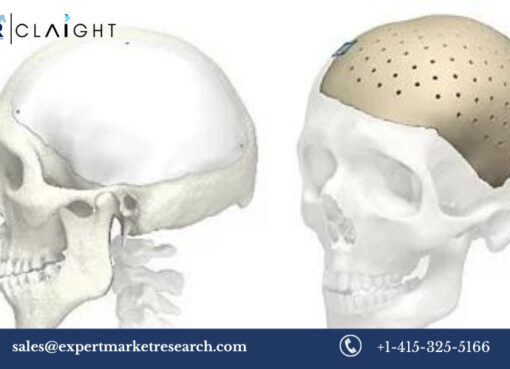 Cranial Implants Market