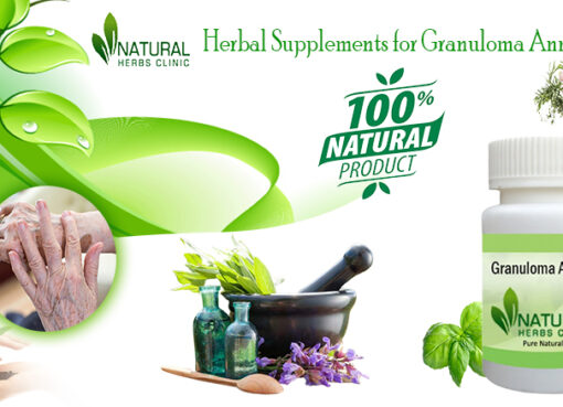 Herbal Supplements For Granuloma Annulare