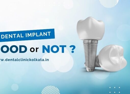 dental implants,dental implant clinic