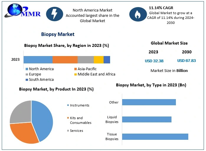 Biopsy Market