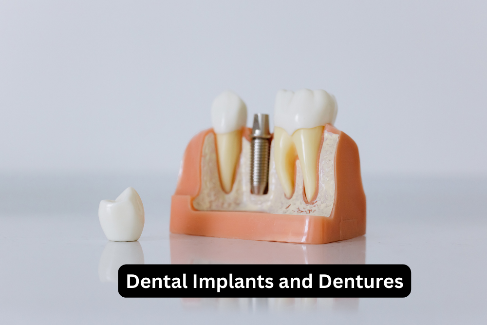 Dental Implants and Dentures: A Comprehensive Guide