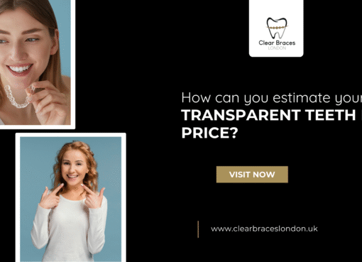 How can you estimate your Transparent teeth brace price
