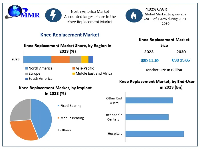 Knee Replacement Market Poised for Growth: Projections Through 2030