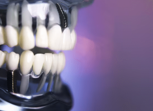 dental implant new orleans