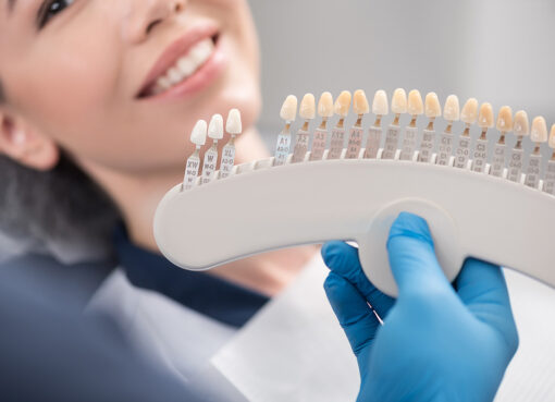 dental veneers in Islamabad