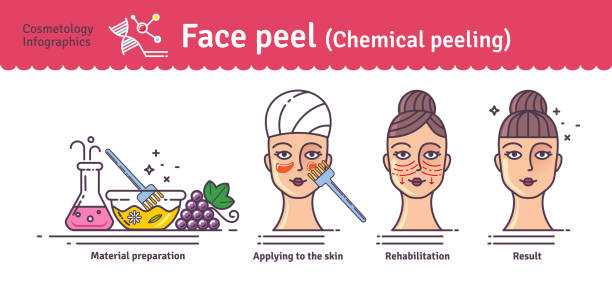 Chemical Peels 101: What Type Is Best for Your Skin?