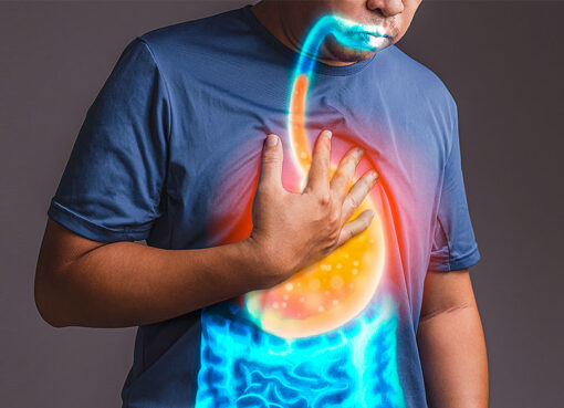 When Should You See a Doctor for Acid Reflux?