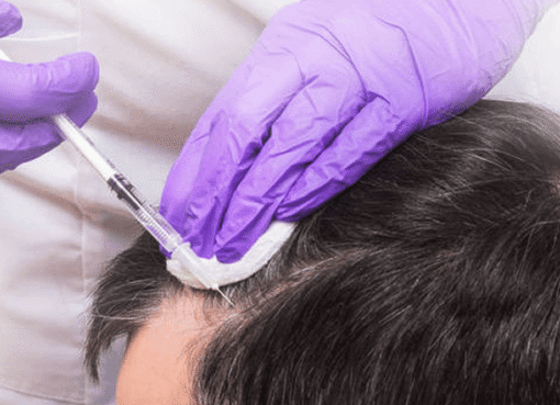 PRP Treatment Cost in Dubai