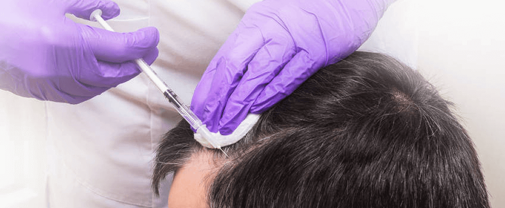 PRP Treatment Cost in Dubai