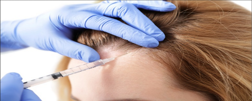 PRP Treatment Cost in Dubai
