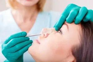 Rhinoplasty in Islamabad