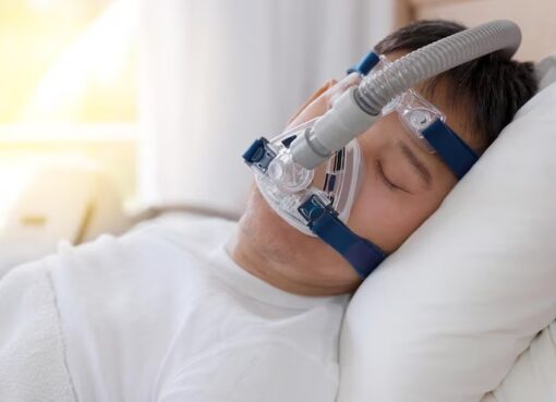 Nasal Masks