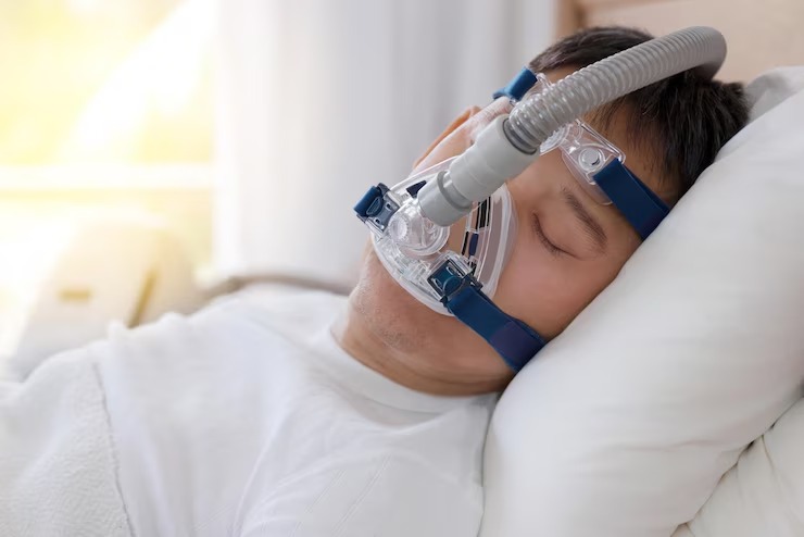 Nasal Masks