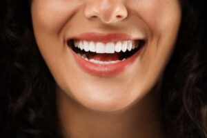 Teeth Whitening