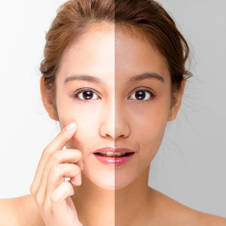 Skin whitening treatment in Islamabad