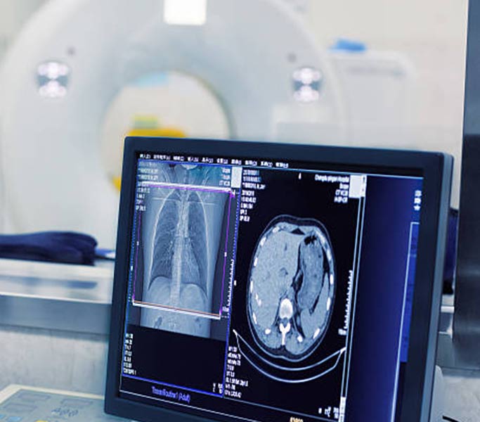 Upgrade old x-ray machine