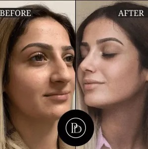 Best Plastic Surgeons in Dubai for Tummy Tuck Transformations