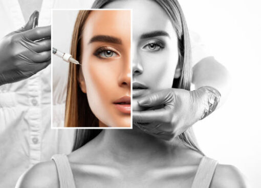 Botox Injections in Riyadh