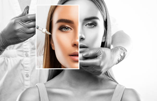 Botox Injections in Riyadh: How Safe Are They? Myths vs. Facts
