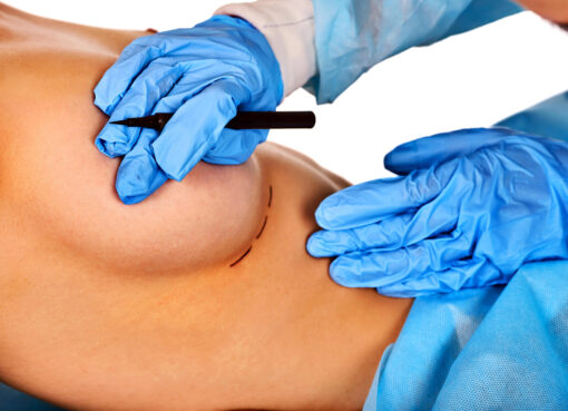 Finding Certified Breast Surgeons in Riyadh