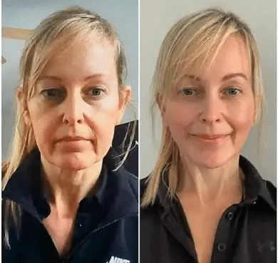 Best Plastic Surgeon in dubai