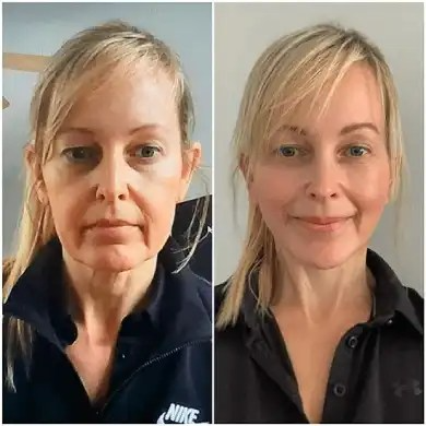 Best Plastic Surgeon in dubai