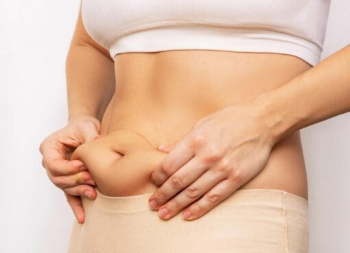 Liposuction in Dubai