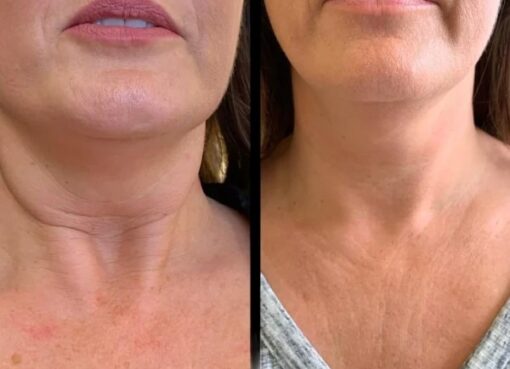 Best Plastic Surgeon in dubai