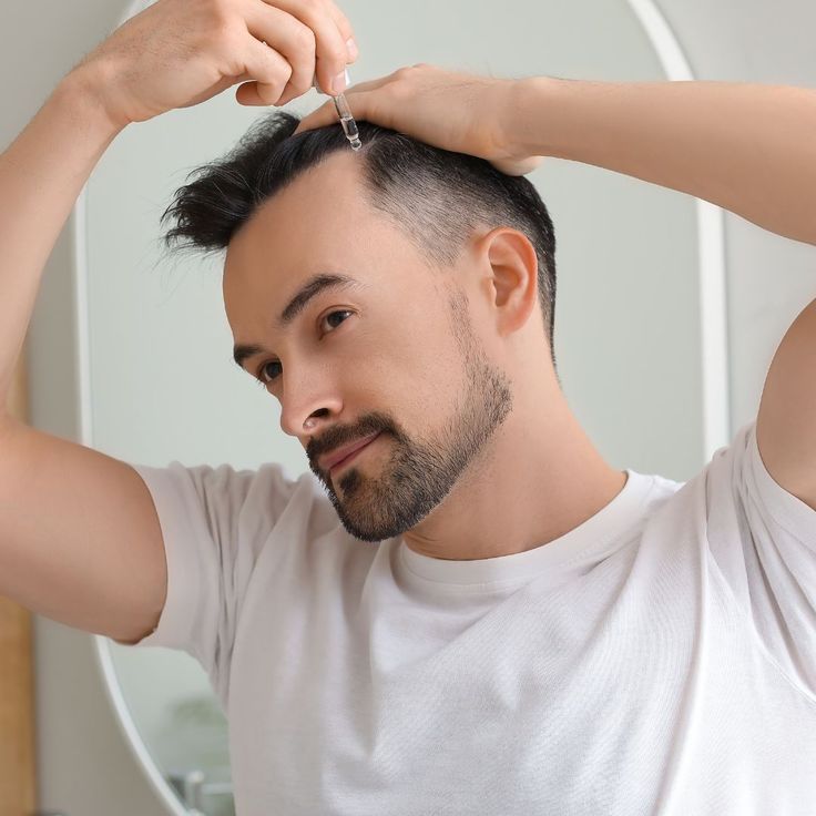 Affordable Hair Transplant Options in Riyadh Today