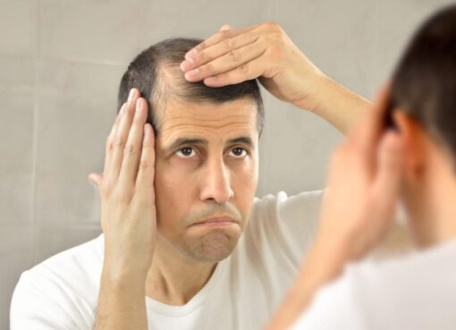 Choosing Your Hair Transplant Doctor in Riyadh