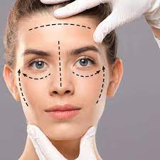 How Long Does a Face Lift Surgery Take to Recover