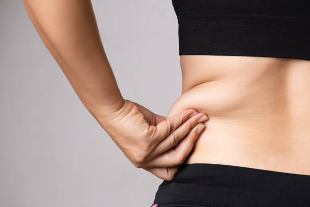 Top Tummy Tuck Trends in Riyadh 2025