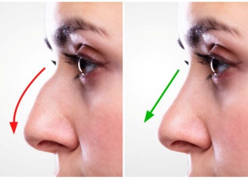 Rhinoplasty in Riyadh: A Complete Patient Guide