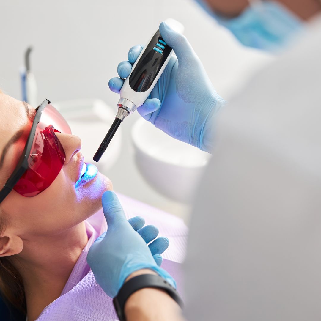 fissure sealants