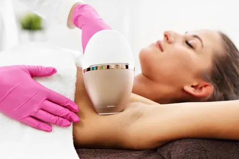 laser hair remove