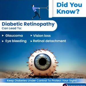 Diabetic Retinopathy