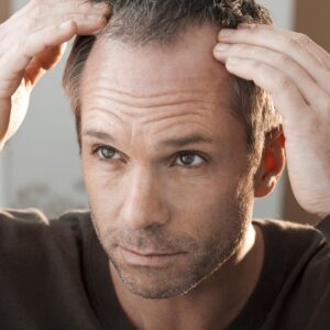 Hair Transplant in Riyadh