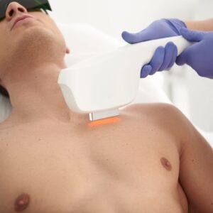 إزالة الشعر بالليزر في الرياض