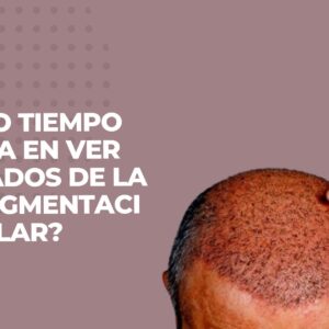 tratamiento de micropigmentacion capilar