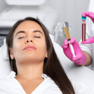 PRP hair treatment in Dubai
