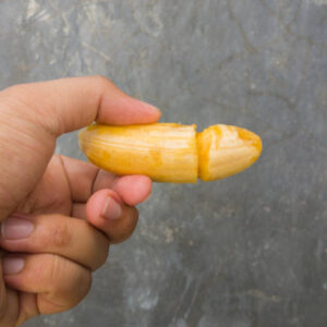 Penile enlargement in Dubai