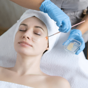 chemical peel in Islamabad (5)