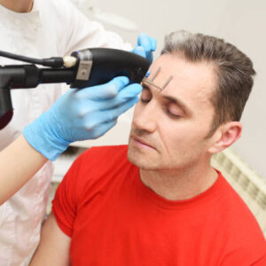 Forehead Lift Surgery in Dubai