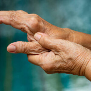 Hand Rejuvenation in Dubai