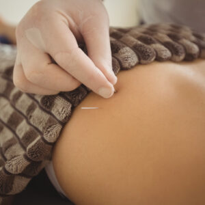 Women’s health acupuncture